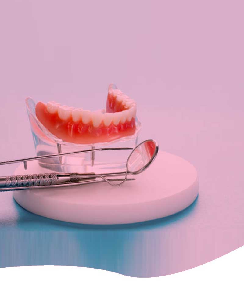 Digital Dentistry, Design and Fabrication